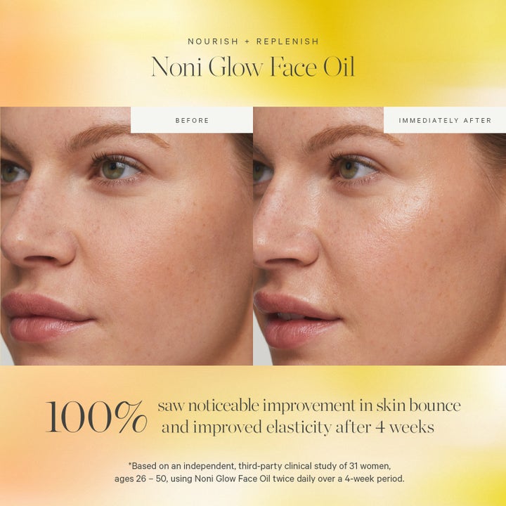 KORA Organics Noni Glow Face Oil 30 ml heleyttävä kasvoöljy ennen ja jälkeen -vertailu näyttää välittömän hehkun iholla.