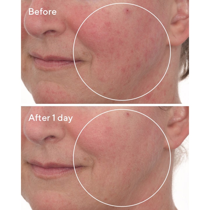 Murad Cellular Hydration Repair Mask 80 ml rauhoittava kasvonaamio lievittää kasvojen punoitusta yhdessä päivässä