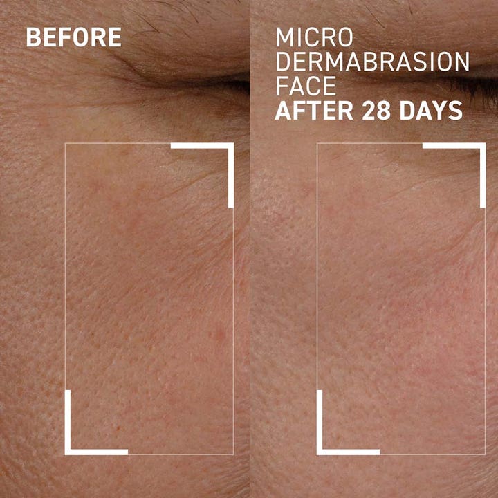 Dr Brandt Microdermabrasion Face Exfoliator 60 g kasvokuorinta ennen ja jälkeen tulos tasaisemmasta ihosta 28 päivässä