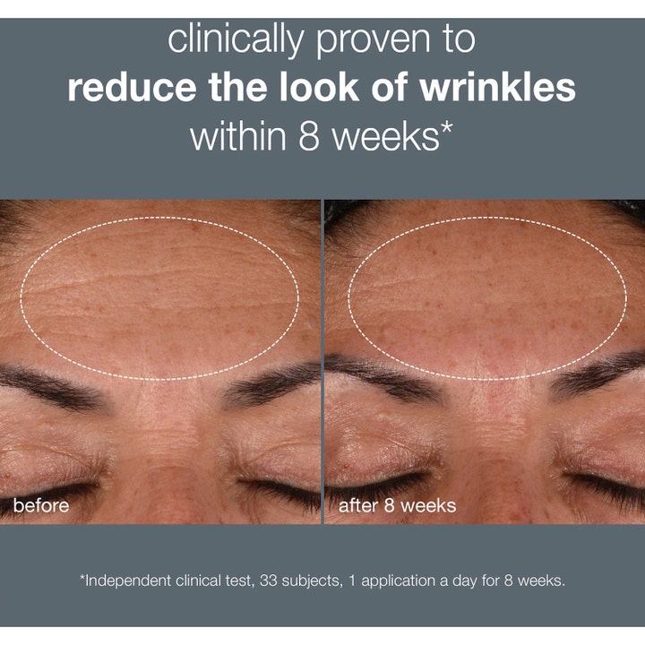 Dermalogica Dynamic Skin Recovery SPF50 15 ml päivävoide ennen ja jälkeen tulokset otsan rypyistä.