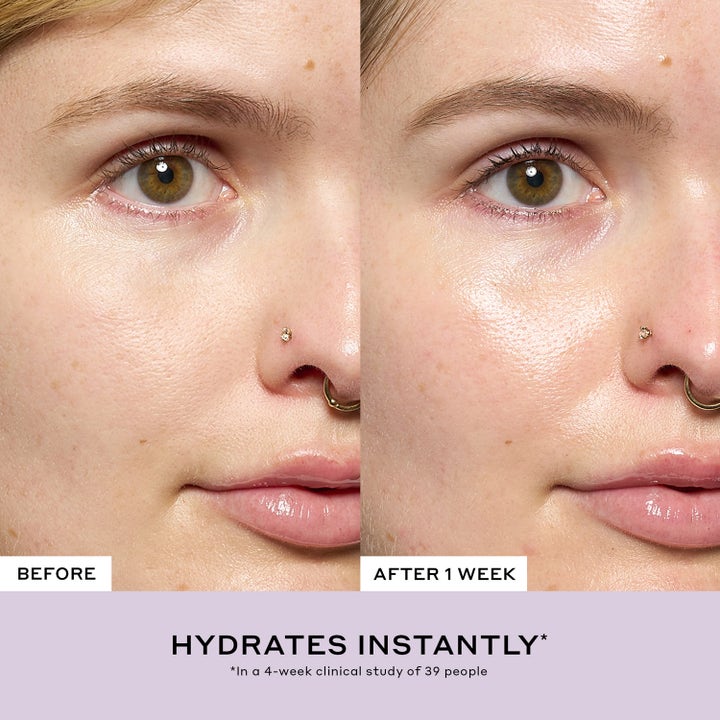 Ole Henriksen Strength Aprés-Skin Rich Rescue Treatment 75 ml kosteuttava voide antaa hehkua ennen ja jälkeen -kuvassa.