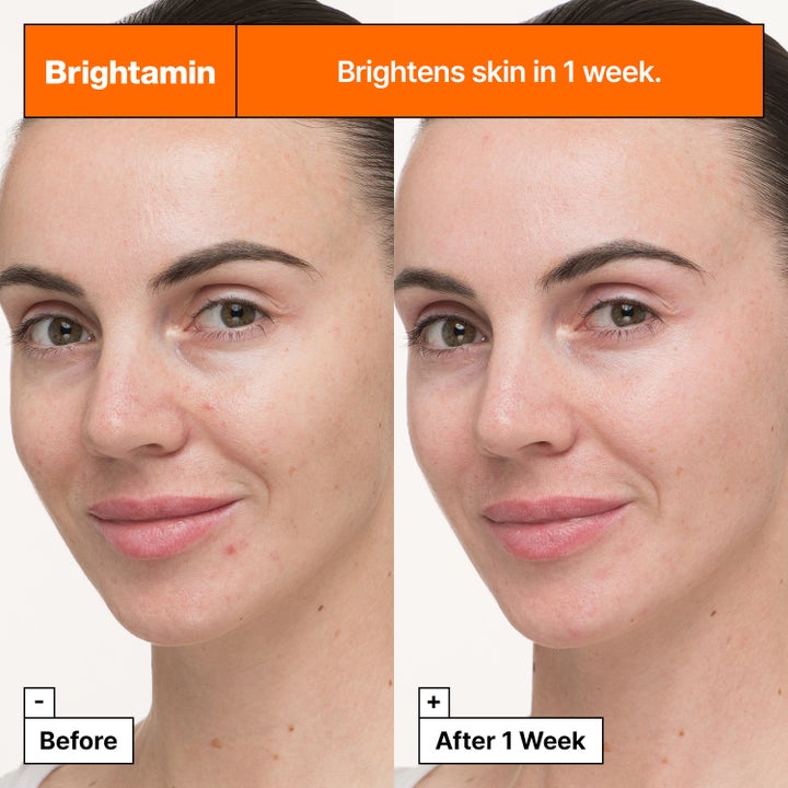 Dr.Jart+ Brightamin Brightening Serum Ampoule 8,08 g kirkastava seerumi ja ennen ja jälkeen -vertailu ihosta.