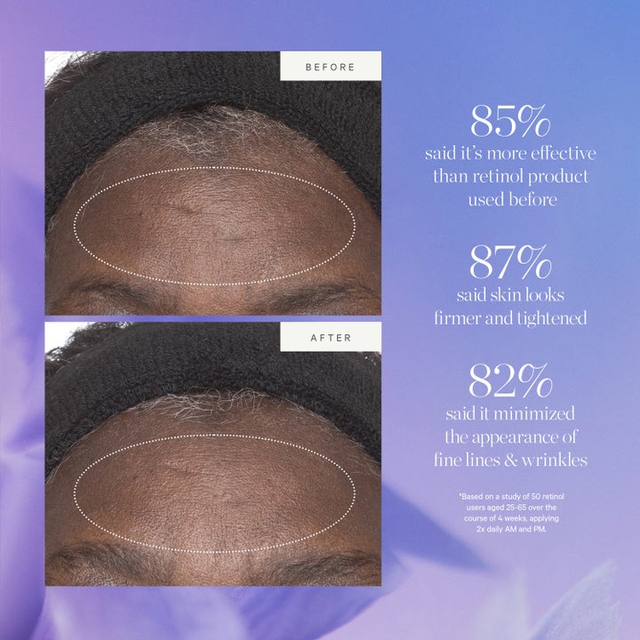 KORA Organics Plant Stem Cell Retinol Alternative Moisturizer 50 ml ennen ja jälkeen kuvat silottavasta voiteesta.