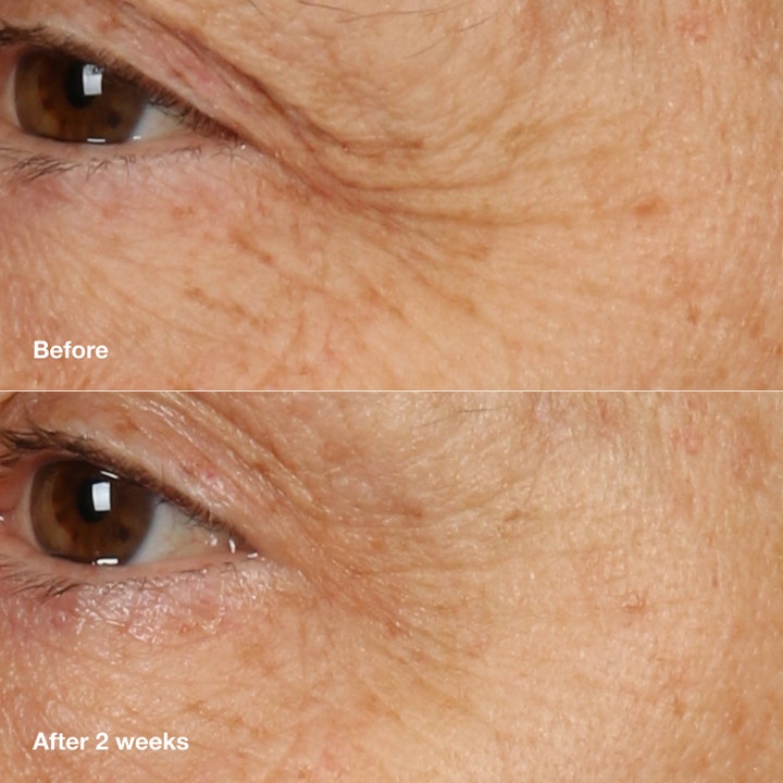 Clinique Smart Clinical Repair Overnight Recovery Cream and Mask 50 ml silottaa ryppyjä ennen ja jälkeen -kuvassa.