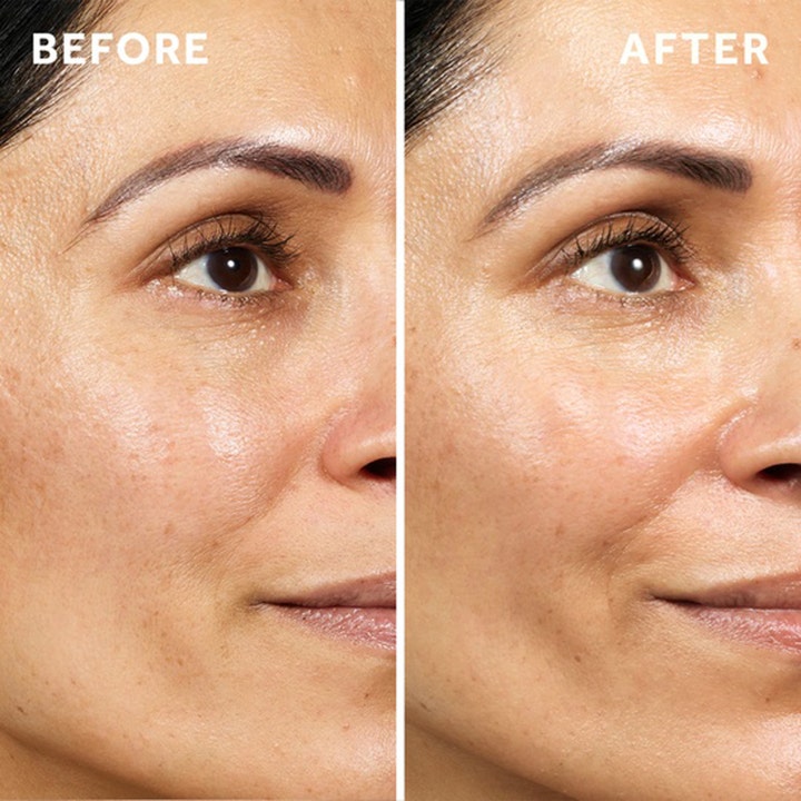 No7 Pure Retinol Triple Action Day Cream 2 x 50 ml silottava päivävoide luo tasaisemman ihon ennen ja jälkeen -kuvassa