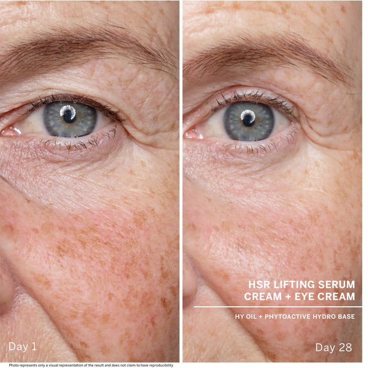 Babor HSR Lifting Serum 30 ml kiinteyttävä seerumi silottaa juonteita silmänympäryksillä 28 päivän käytön jälkeen