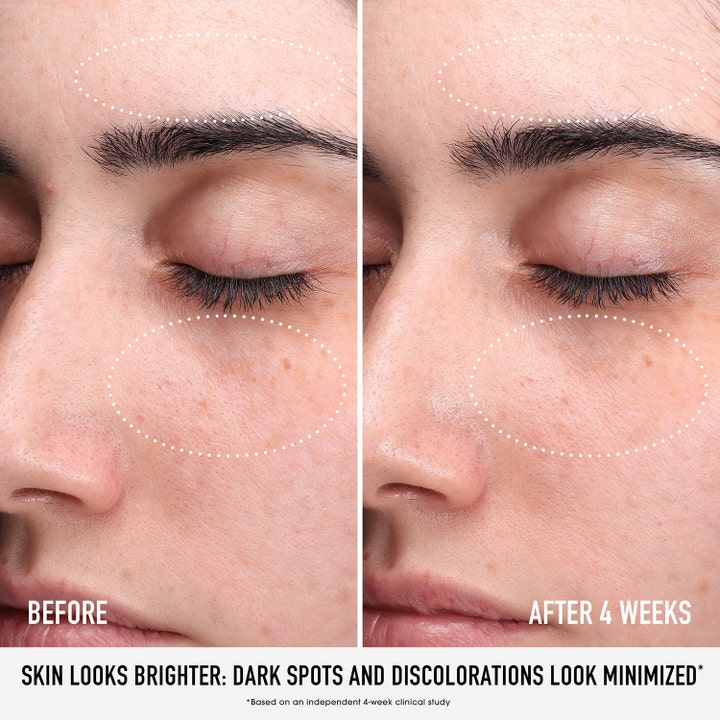 bareMinerals Skin Rescue Pure Glow Serum 30 ml kirkastava seerumi ennen ja jälkeen kuvassa häivyttää tummia läiskiä