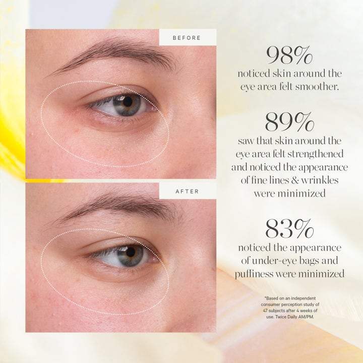 KORA Organics Kakadu Plum Vitamin C Eye Cream 15 ml kirkastava silmänympärysvoide ennen ja jälkeen kuvat