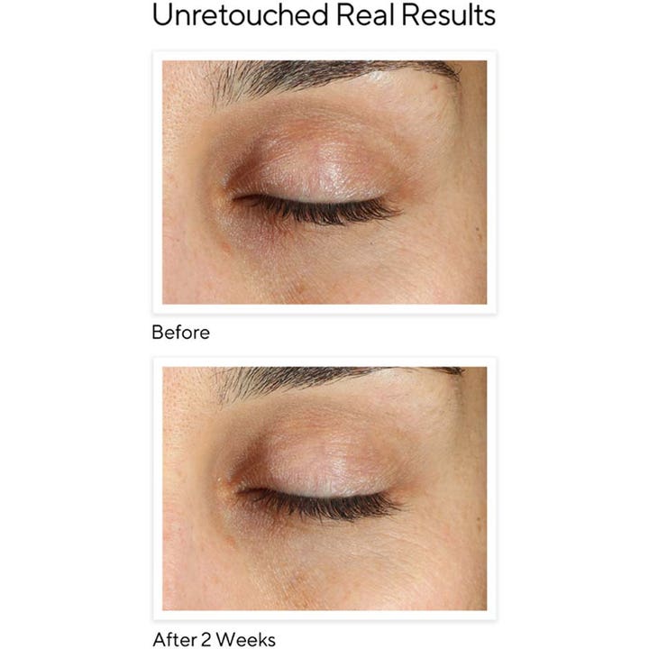 Murad Vita-C Eyes Dark Circle Corrector 15 ml kirkastava silmänympärysvoide ennen ja jälkeen tulokset 2 viikossa.