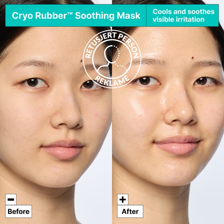 Dr.Jart+ Cryo Rubber Soothing Mask 40 g rauhoittava kasvonaamio ennen ja jälkeen tulos kuvattuna kasvoilla