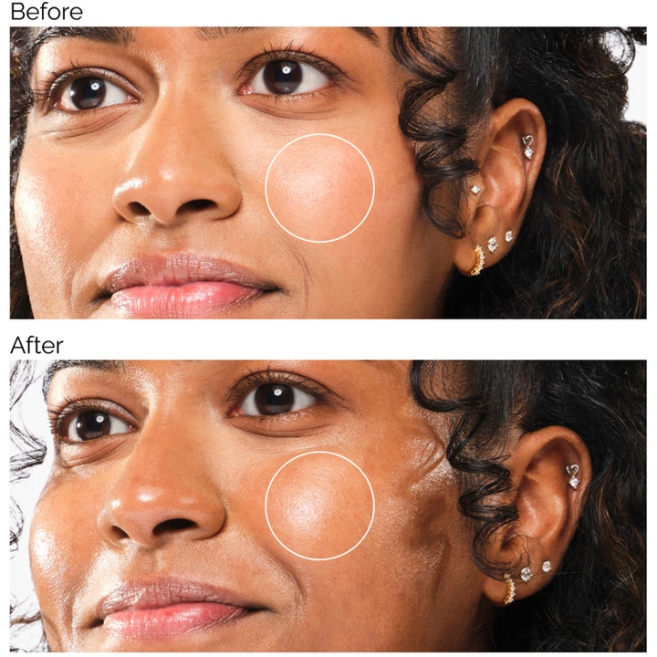 The Ordinary UV Filters SPF45 Serum 60 ml aurinkosuoja ennen ja jälkeen kuvassa naisen kasvoilla.